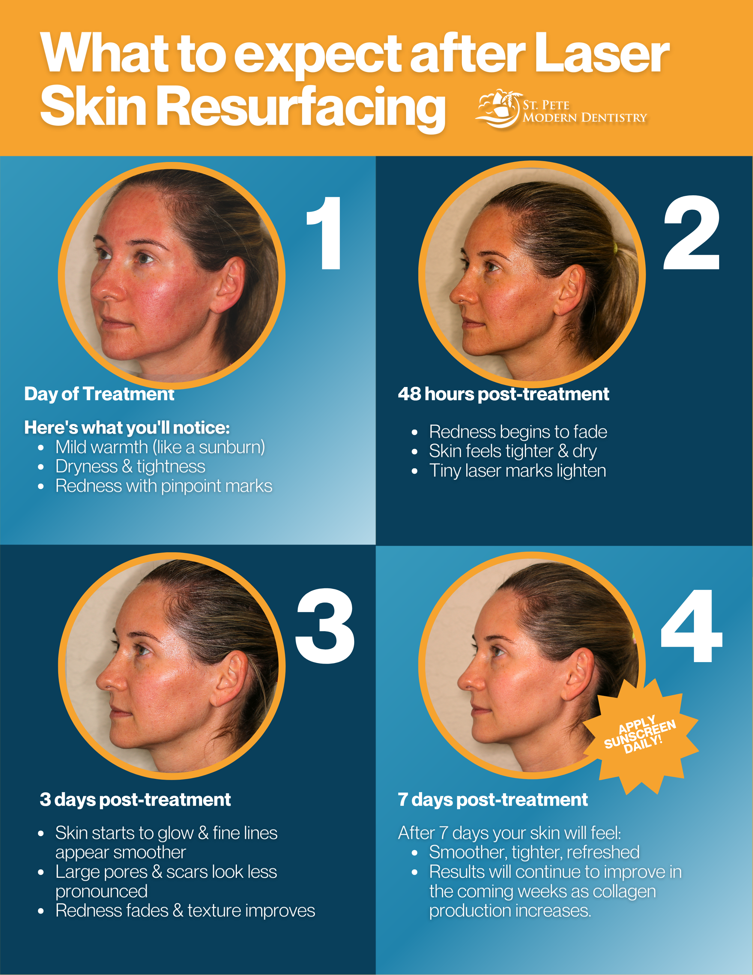 Laser skin treatment example